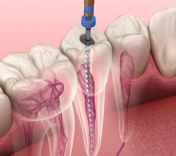 3bc5c2113546f9955442aeeaf5b67303