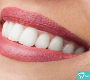 6c3d417599e8c3fa2b9006a78a2d7474