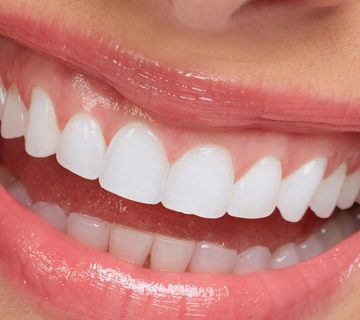 dis implant tedavisi yeni teknoloji ile 7 gune dusecek