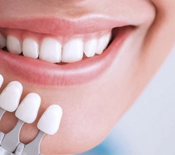 kompozitnye viniry p