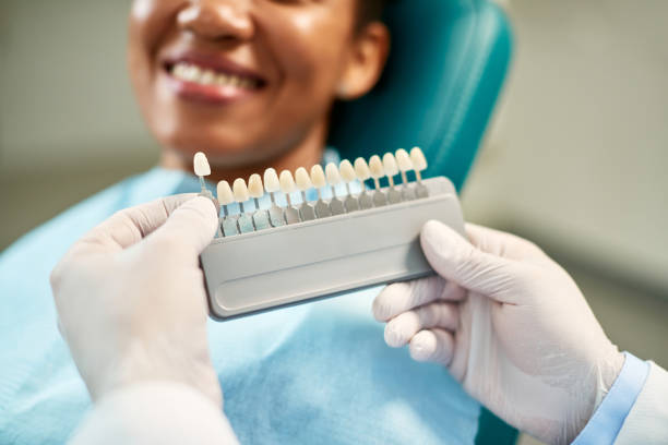 close up of dentist chooses right shade of implants during dental appointment with female