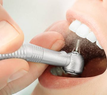 close up of dentist hand drilling the teeth and spraying 2