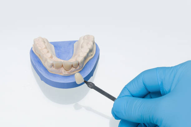 close up of hand and tool for checking color of dentures in dental laboratory