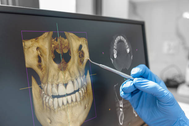 dental consultation with 3d tomography image 3