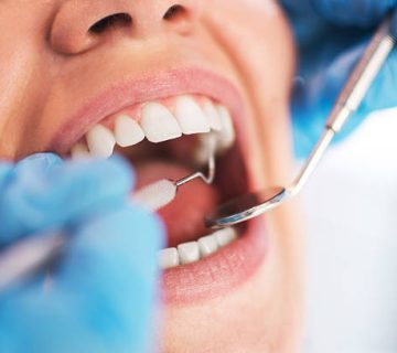 open female mouth during oral checkup at the dentist selective 1