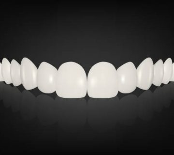 vector 3d realistic render white denture set closeup isolated dentistry and orthodontics 3