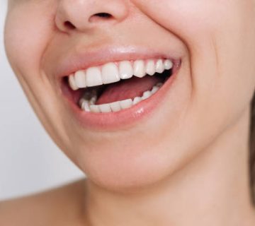 young caucasian blonde woman with perfect white even teeth dentistry beautiful smile