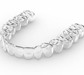 3d render of invisalign removable retainer 1