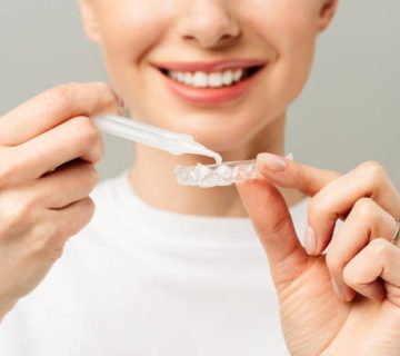 a young woman does a home teeth whitening procedure whitening tray with gel 2