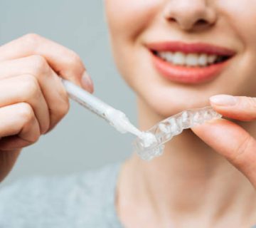 a young woman does a home teeth whitening procedure whitening tray with gel