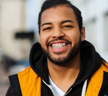 african american student with dental braces wearing jacket posing on street and looking at 1