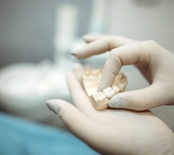 checking dental impression