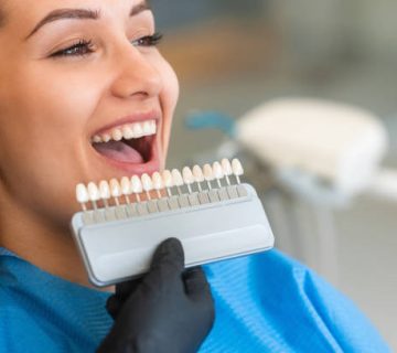 choosing a shade of dental veneers 2