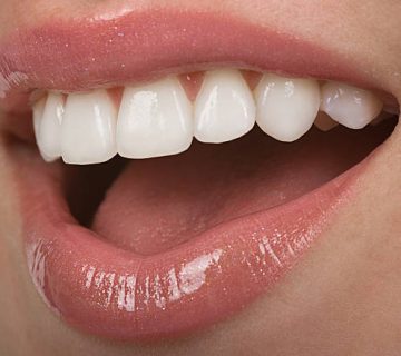 close up of white top set of teeth and glossy pink lips