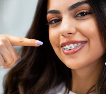 cute young woman with dental braces smiling and pointing to them 2