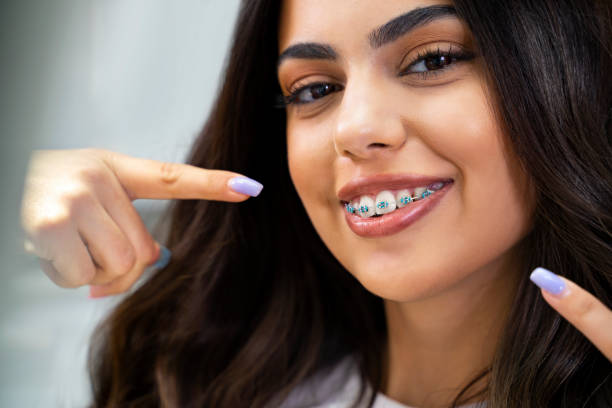 cute young woman with dental braces smiling and pointing to them 2