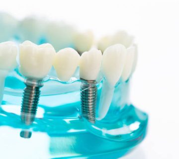 dental model on white background