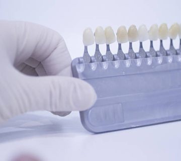 dental nurse holding implant and crown tooth color guide