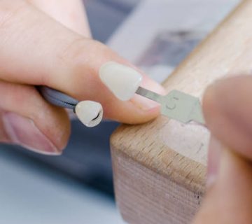 dental technician comparing ceramic tooth with dental color shade guide 1