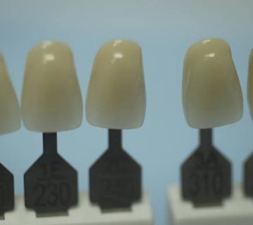 dental tooth color guide for implants and crown colors