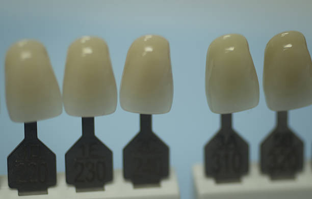 dental tooth color guide for implants and crown colors