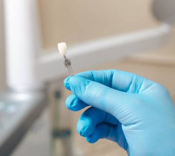 dentist in blue gloves showing pallete of tooth color 1