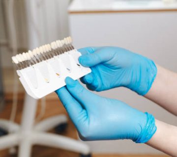 dentist in blue gloves showing pallete of tooth color