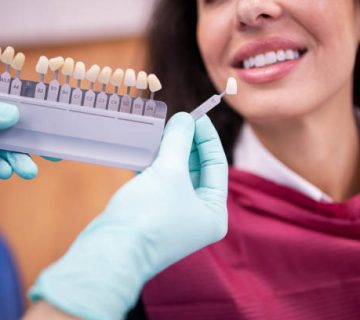 dentist matching the right white tone for a dental crown