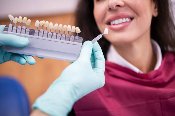 dentist matching the right white tone for a dental crown