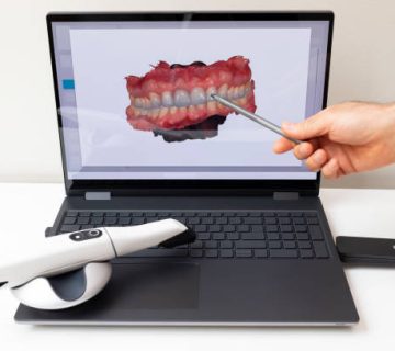 dentist shows 3d scanned picture of scanned teeth on monitor of computer white 3d intraoral