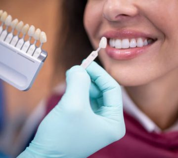 dentist using a palette tooth color sample 6