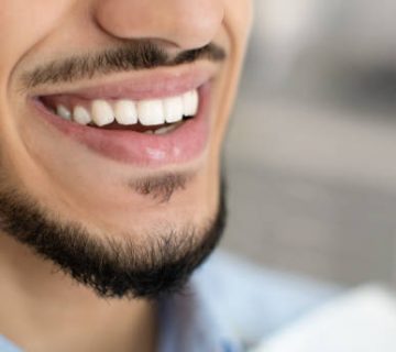 dentistry concept closeup of happy young middle eastern man smiling with perfect teeth