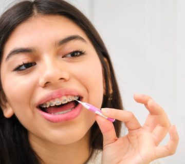 female teenager cleaning her braces with an interdental brush