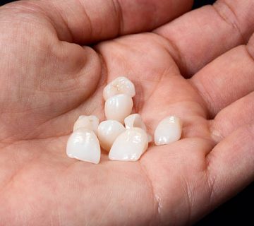 hand with dental veneers