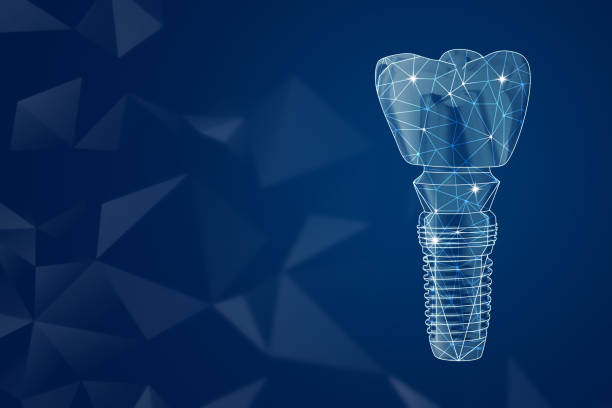 illustration of dental implant on dark blue background space for text 1
