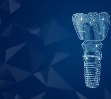 illustration of dental implant on dark blue background space for text 2
