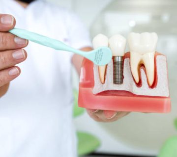 male dentist explaining tooth implantation