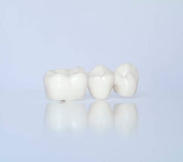 metal free ceramic dental crowns 1