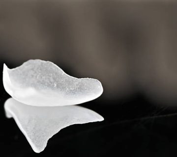 micro prepless veneer