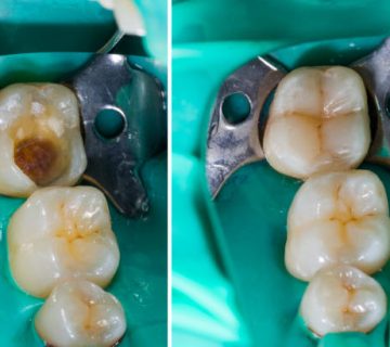 mimicking nature in dentistry