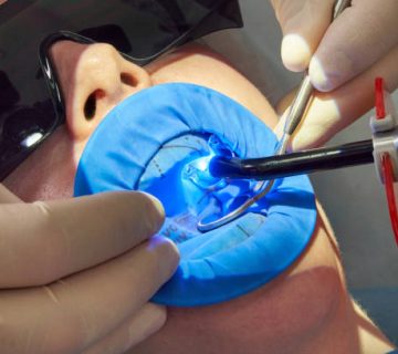 patient getting dental treatment at dentist office with dental rubber dam protection