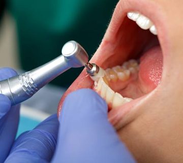 professional dental brushing 2