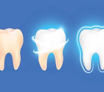 set of clean and dirty tooth on blue background clearing tooth process