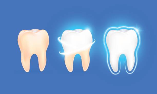 set of clean and dirty tooth on blue background clearing tooth process