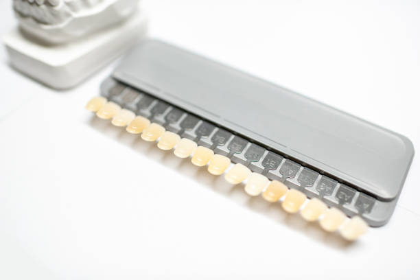 set of veneers for tone selection