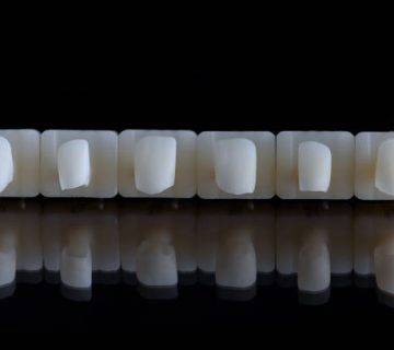six upper jaw frontal ceramic crowns prosthesis on black glass background artificial jaw with