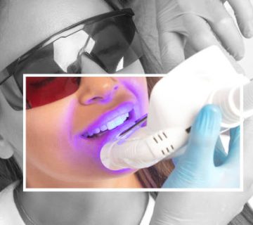 the dentist makes a teeth whitening procedure in the clinic to a young beautiful woman a