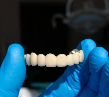 the doctor holds in his hands a zirconium prosthesis for all the teeth of the jaw