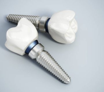titanium dental implant models