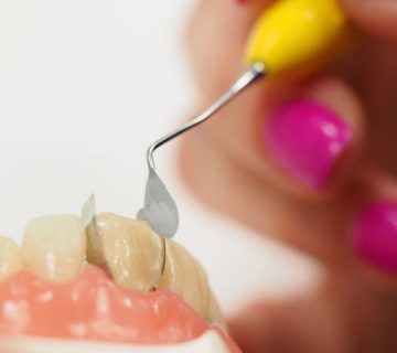 training for anterior composite restorations